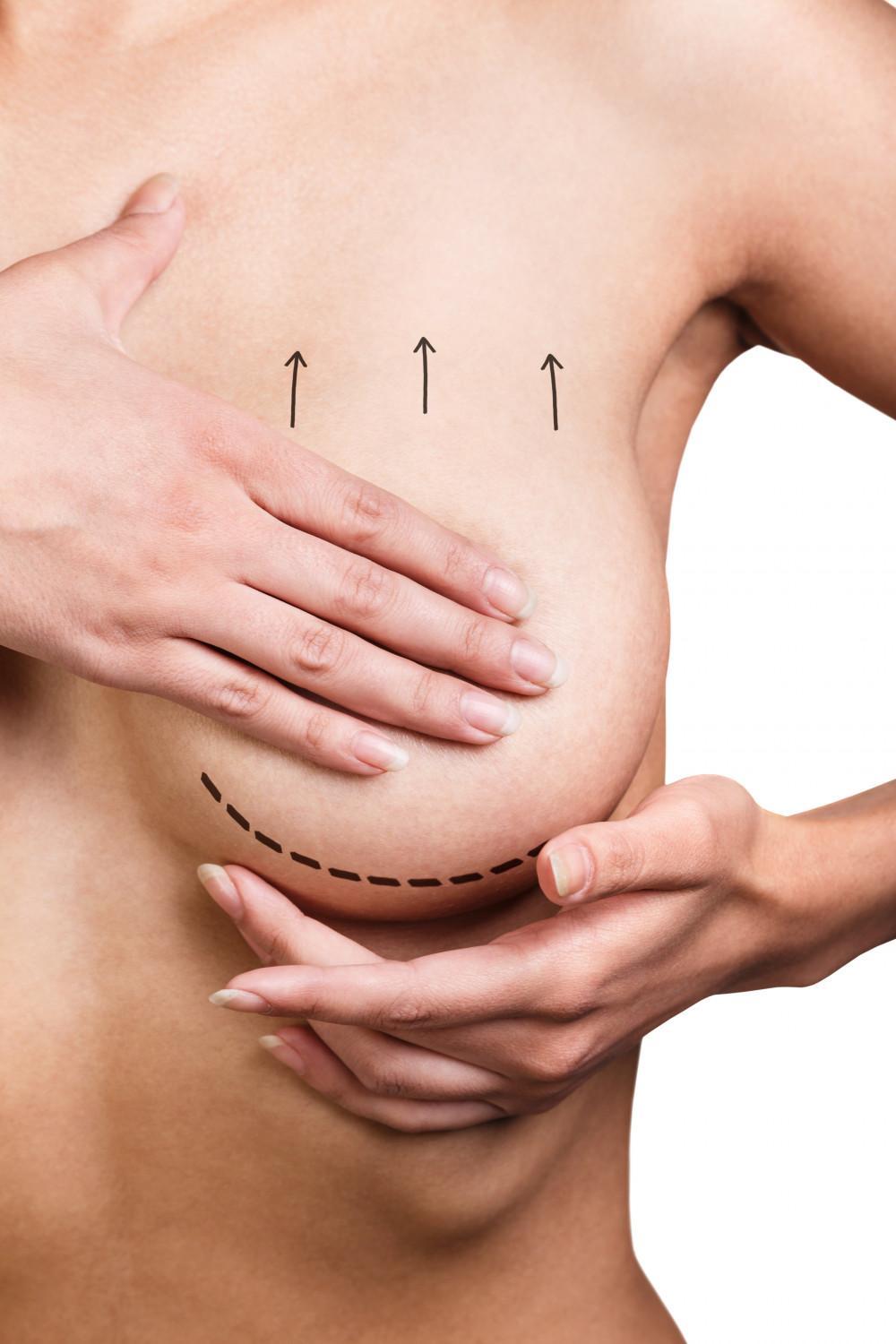 Before and after photo showing enhanced shape and contour from breast and body cosmetic surgery in Turkey
